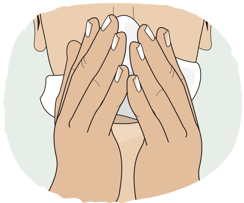 Illustration of person blowing nose to clear nostrils before using Tosymra nasal spray